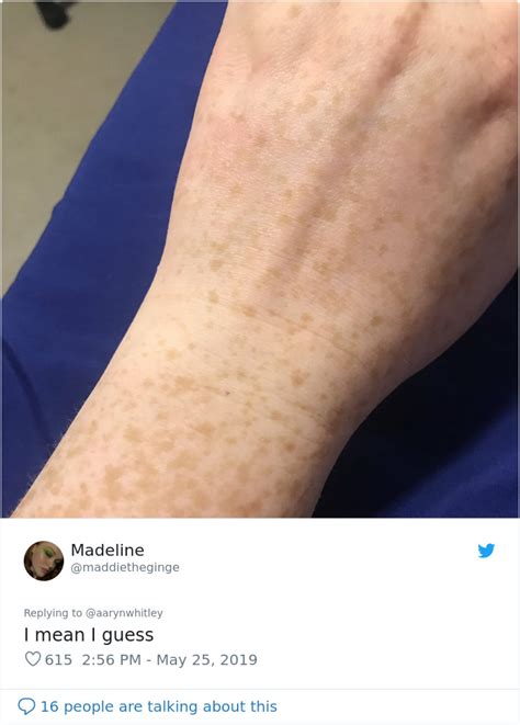 Someone Claims All Women Have A Freckle In The Middle Of Their Wrists