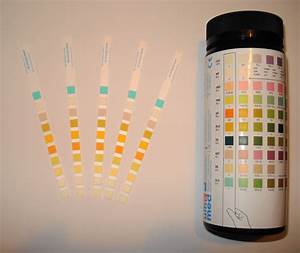 Urinalysis Strips Urine Test Kits Urine Reagent Urine