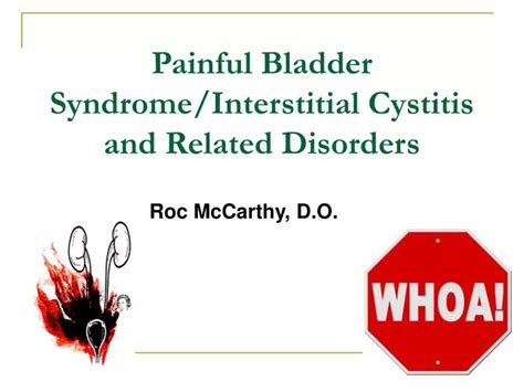 Ppt Painful Bladder Syndromeinterstitial Cystitis And Related