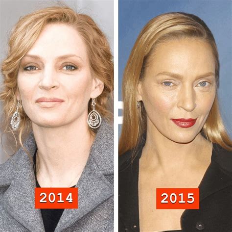 Uma Thurman Before And After Plastic Surgery 03 Celebrity Plastic