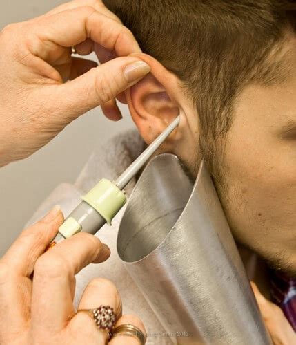 Symptoms are typically pain and hearing loss. How to Clean Your Ears - Earwax Removal - DoctEar