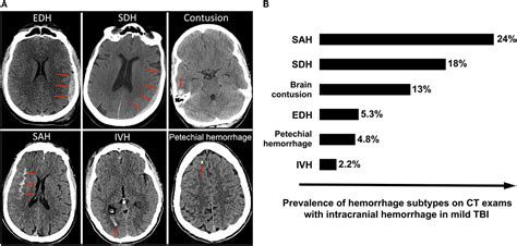 Frontiers Computational Approaches For Acute Traumatic Brain Injury