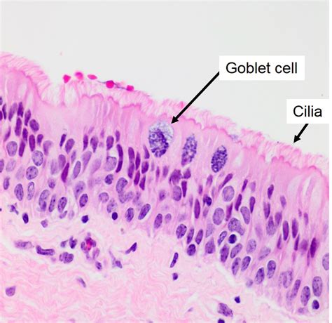 Trachea Histology Labeled