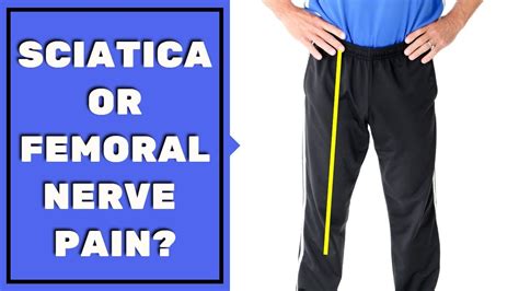 Is Leg Pain Sciatica Or Femoral Nerve Pain Must See To Assess And Stop