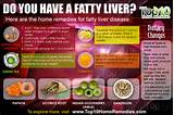 Photos of Home Remedies Fatty Liver