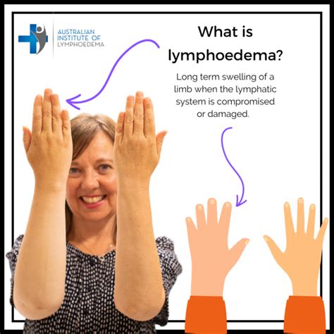 What Is Lymphoedema Australian Institute Of Lymphoedema