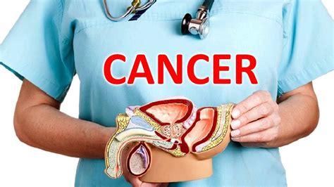 Prostate Cancer Symptoms Causes And Treatment Men S Health