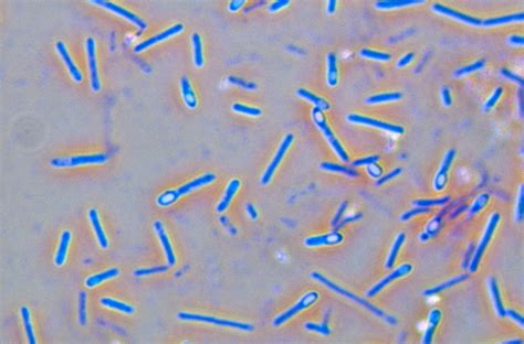 Cette spore peut résister à de faibles traitements thermiques (ex : Clostridium Botulinum, Lm Photograph by Michael Abbey