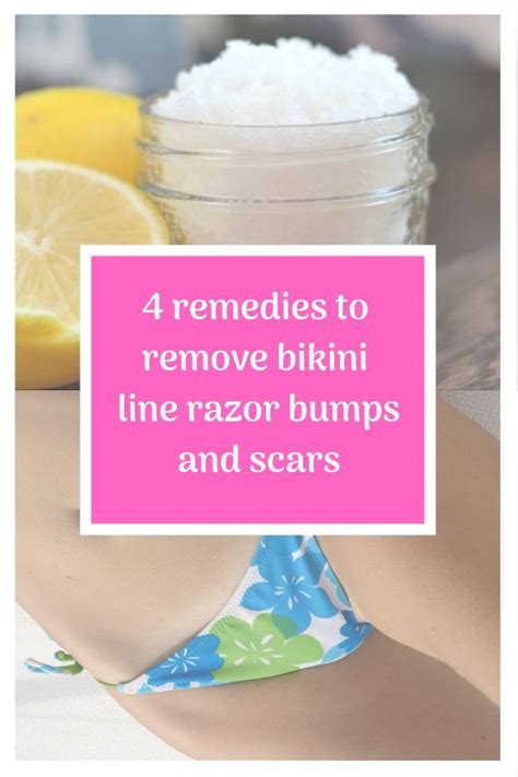 quick way to get rid of razor bumps