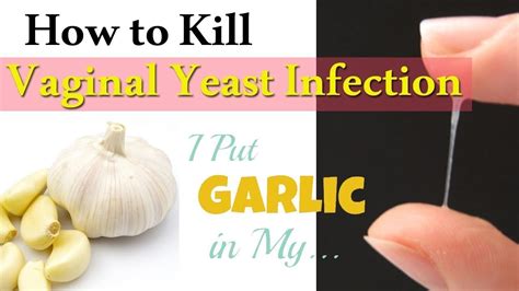 How O Get Rid Of Yeast Infection In 3 Days😍😍 Youtube