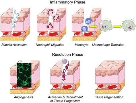 Phases Wound Healing Process Cross Section Stock Vect