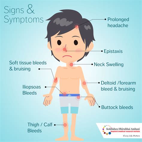 Symptoms Of Hemophila Health Tips From Kokilaben Hospital