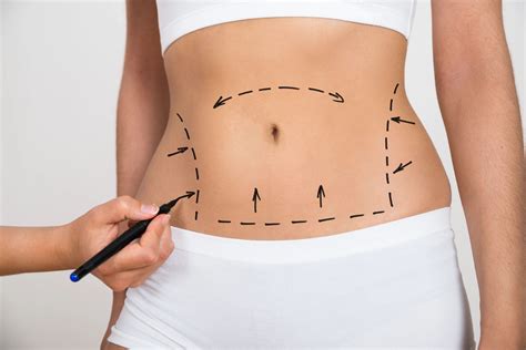 How To Avoid Sagging Skin After Weight Loss And What To Do If You Cant