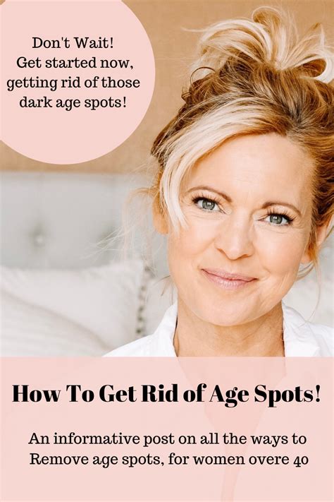 How To Get Rid Of Age Spots Artofit