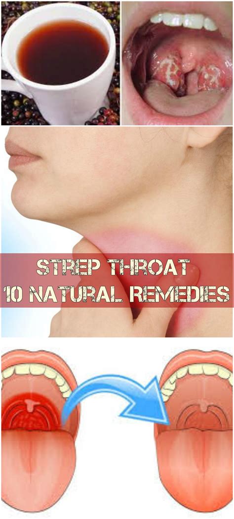 How Long Does Itchy Throat Last However A Sore Throat Caused By Allergies Can Last For As