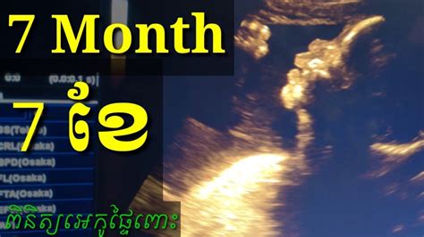 ពិនិត្យឣេកូផ្ទៃពោះ 7ខែ Pregnancy Ultrasound 7month By Drbun Laysophea
