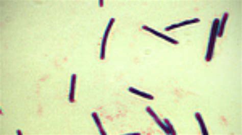And what can you do to get over it? Clostridium perfringens: The facts | London - ITV News