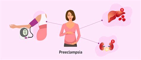 Qu Es La Preeclampsia En El Embarazo Por Qu Se Produce