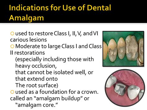 Solution Dental Amalgam Ppt 2 Dm Lectures Studypool