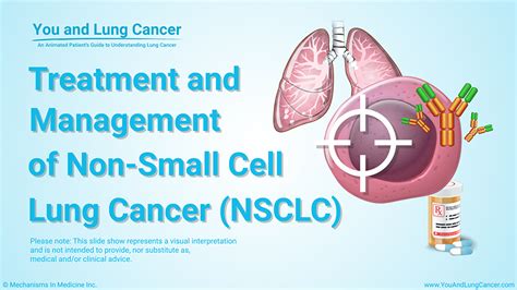 Lung cancer remains one of the most wide spread malignant oncologic illnesses. Slide Show - Treatment and Management of Non-Small Cell ...