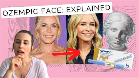 Is Ozempic Ageing Your Face What Is Ozempic Face Dr Sarah Explains