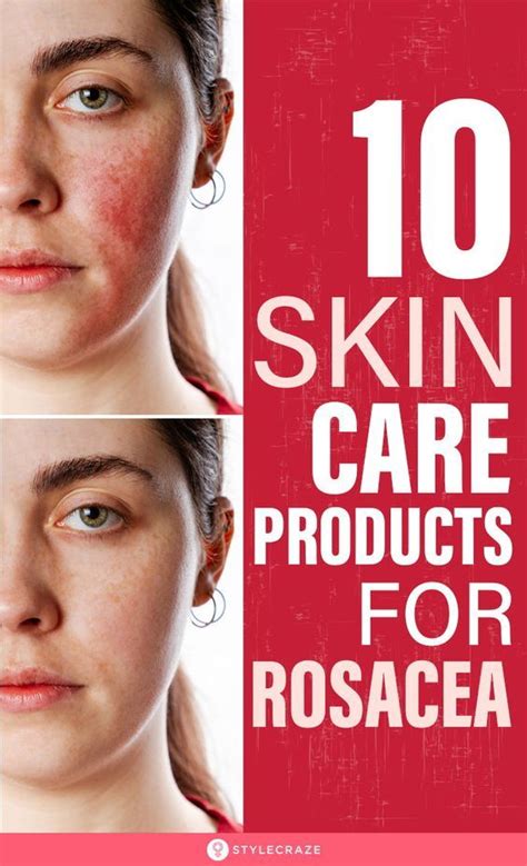 The 15 Best Skin Care Products For Rosacea Of 2021 Rosacea Skin Care