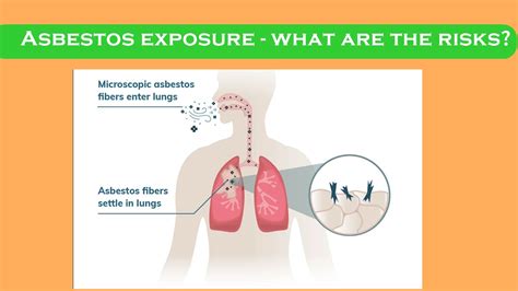Asbestos Exposure What Are The Risks