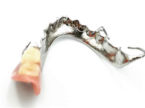 Removable Partial Chrome Metal Dentures Are Another Type Of Partial
