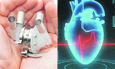 Iit Kanpur Ready With Artificial Heart The Hitavada
