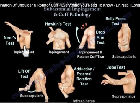 Clinical Examination Of Shoulder And Rotator Cuff