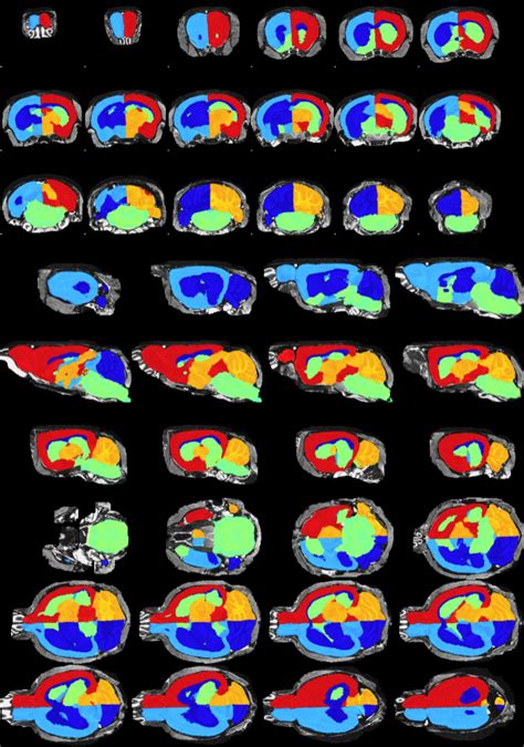 Multi Template Mri Mouse Brain Atlas Dataset Papers With Code