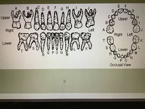 Dh 113 Deciduousprimary Dentition Flashcards Quizlet