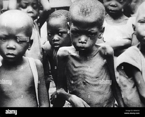 The Starving Children Of Ethiopia Stock Photo Alamy