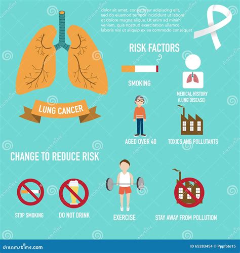 Lung Cancer Risks And Change To Reduce Infographics Illustration Stock