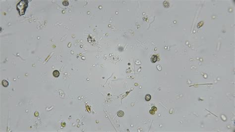 Microorganisms In Pond Water Under Microscope
