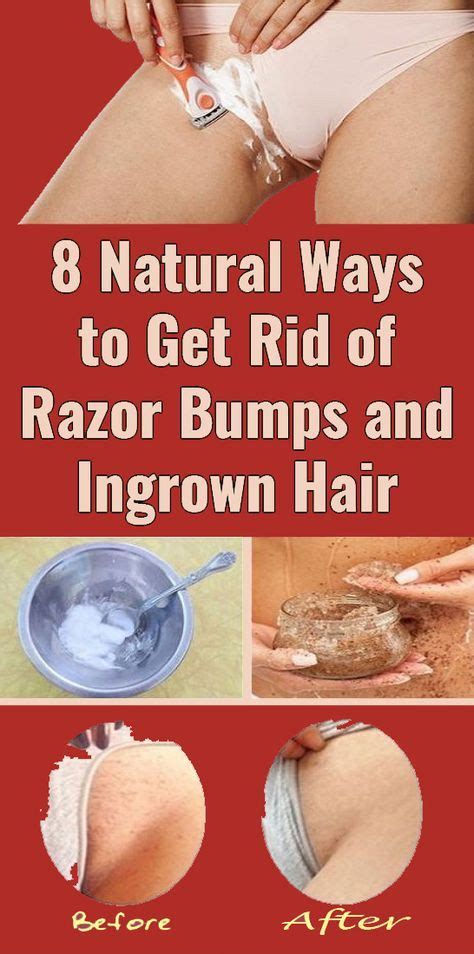 How To Get Rid Of Hair Bump Scars