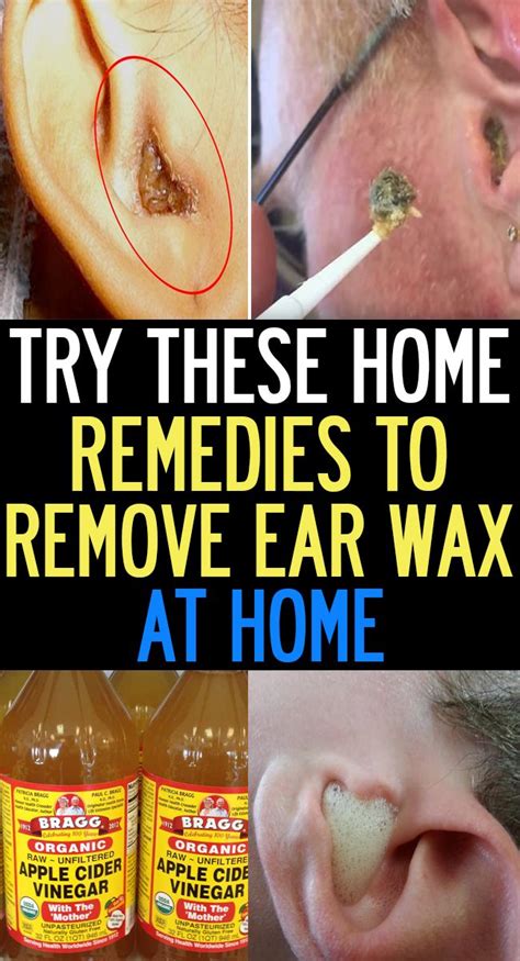 Natural Home Remedies To Remove Ear Wax At Home Quick Look Natural