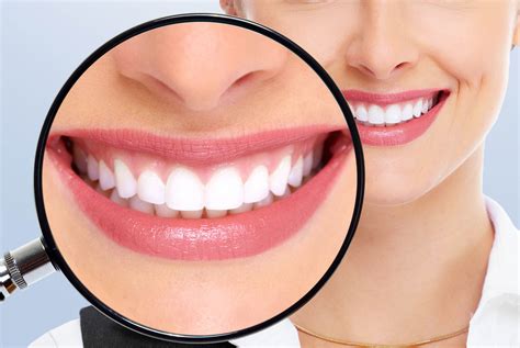 Estética Dental ¿cómo Ayuda A Mejorar Tu Sonrisa Inmedent Clínica