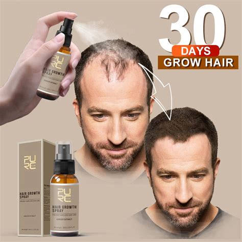 Miracle Hair Growth Spray – Frequent Forage