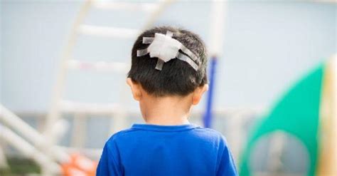 Jadi bayi yang beberapa kali jatuh dan tidak mengalami kecederaan atau hanya mengalami kecederaan kulit kepala tidaklah perlu dibimbangkan, ujarnya. Bahaya Anak Jatuh Mengenai Kepala Belakang, Parents Waib ...