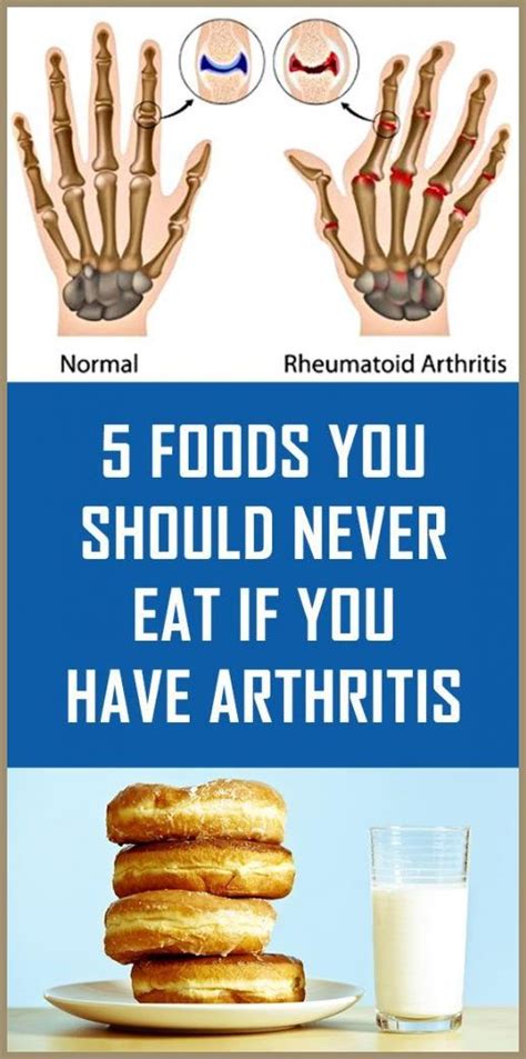 5 Foods You Should Never Eat If You Have Arthritis In 2020