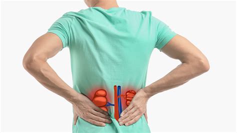 Understanding Renal Pelvic Inflammation Causes Symptoms And