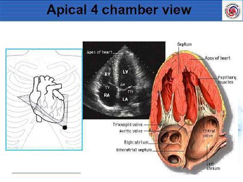 Standard Imaging Of Transthoracic Echocardiography Terminology A