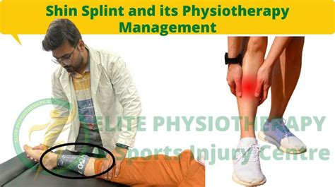 Shin Splint And Its Physiotherapy Management
