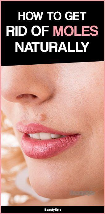 How To Get Rid Of Moles Naturally Skin Moles Skin Moles On Face