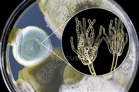 Colonies Of Penicillium Fungi Grown On Sabouraud Dextrose Agar And