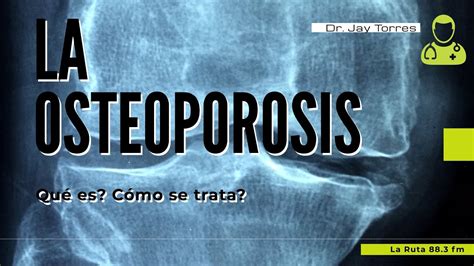 La Osteoporosis Qué Es Cómo Es Su Tratamiento Youtube