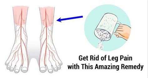 The 10 Best Home Remedies For Your Leg Pain Health And Healthy Living