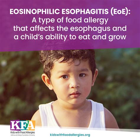 Eosinophilic Esophagitis Eoe
