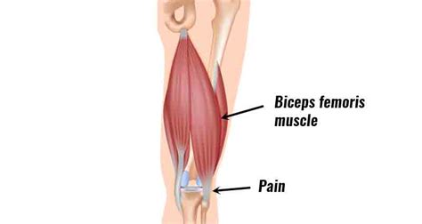 Hamstring Tendonitis Symptoms Causes Treatment And Exercises